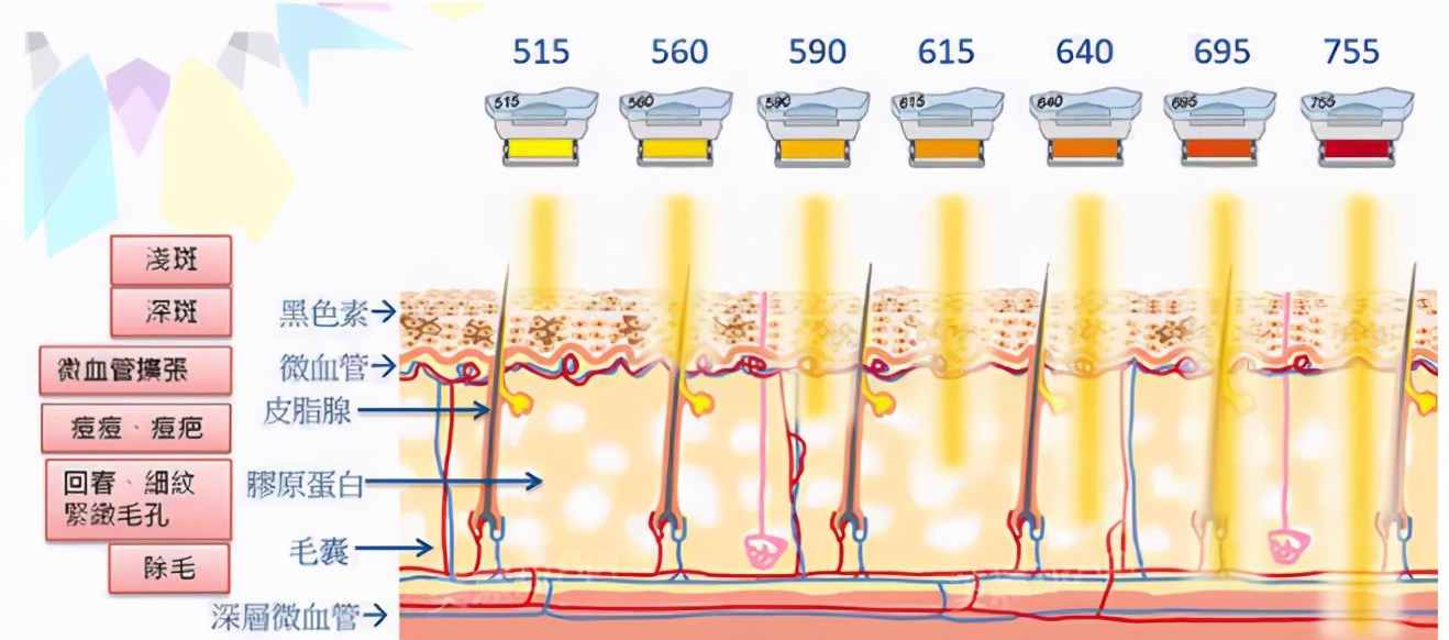 光子和超光子有什么区别,超光子比光子嫩肤贵吗