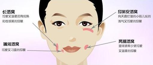 人造酒窝值得做吗,人造酒窝能坚持几年