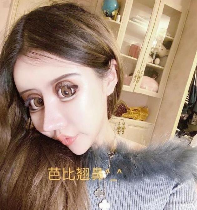 隆鼻多大年龄能做,隆鼻有年龄限制