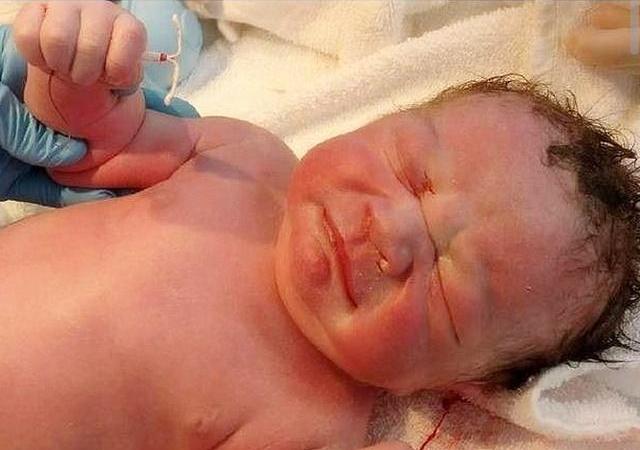 新生儿出生手握避孕环,新生儿手里抓着避孕环