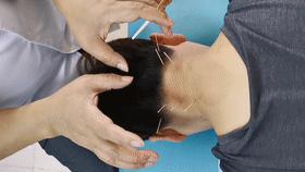 头晕颈椎病的最好治疗方法,针灸推拿拔罐能治疗颈椎病吗