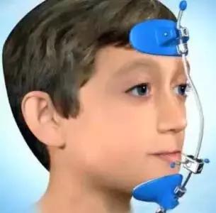 孩子地包天怎么治疗最有效,小孩地包天最佳治疗方法