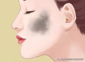 做一个脸上无斑的女人,女人脸上没有斑了