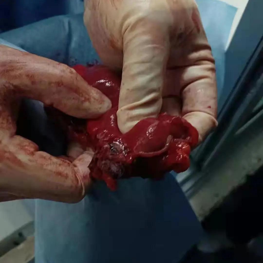 鎮ｇ檶鐖哥埜,鎮ｇ檶鐖朵翰