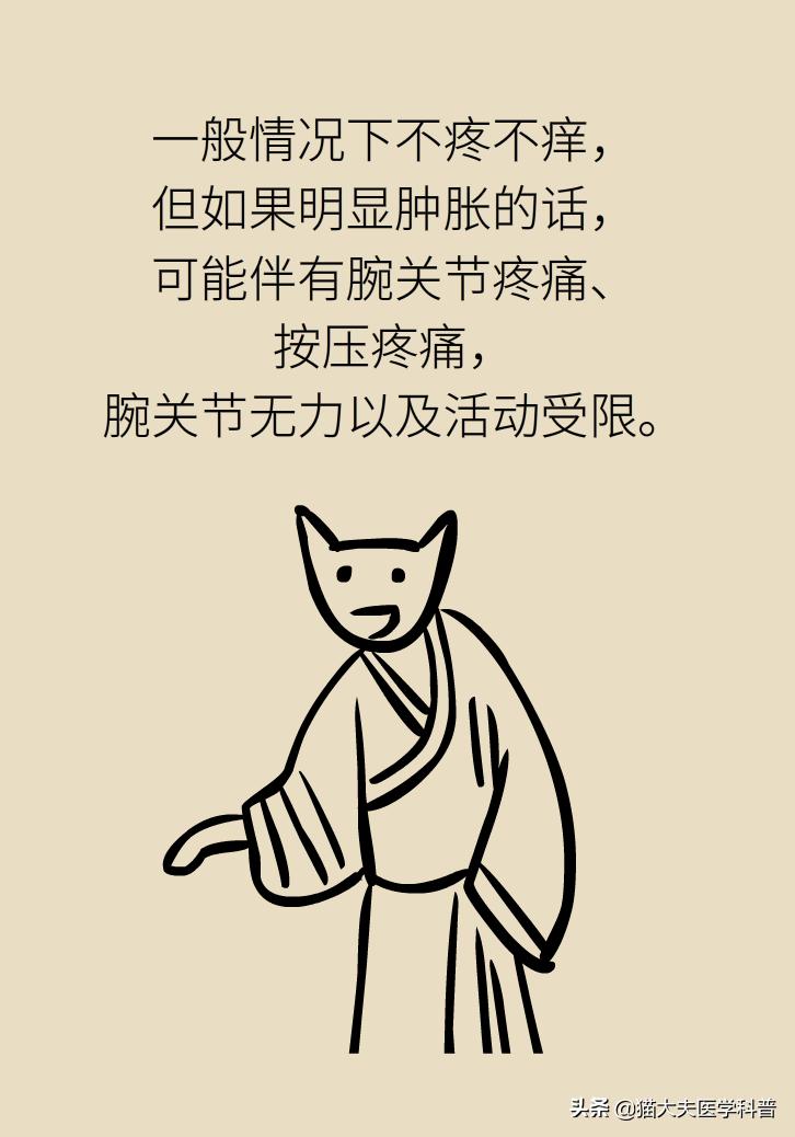 手腕长腱鞘囊肿,手腕上有个凸起的包腱鞘囊肿