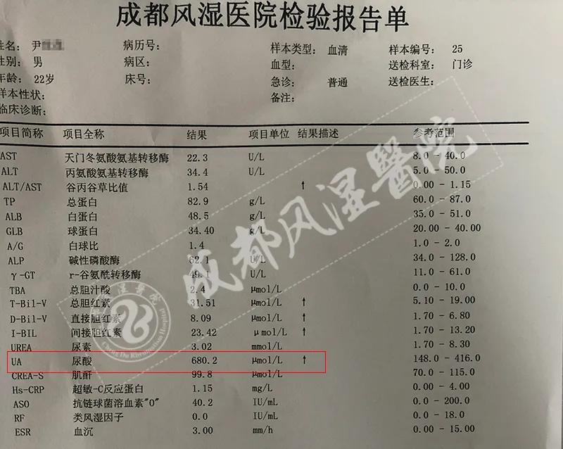 尿酸超过正常值当心痛风肾衰竭,尿酸近700有必要吃药吗