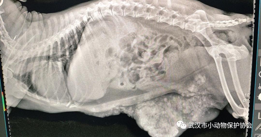 拳头大小的肿瘤可能是良性的吗,肿瘤长得越来越大就是癌症晚期吗