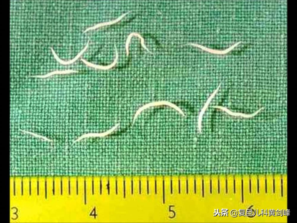 宝宝总喊屁屁痛,屁屁痒,屁屁不舒服是咋回事?