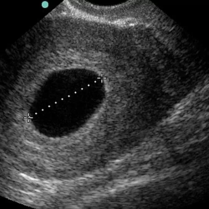 流产有多痛只有经历过才会懂,流产只有经历过才知道痛苦