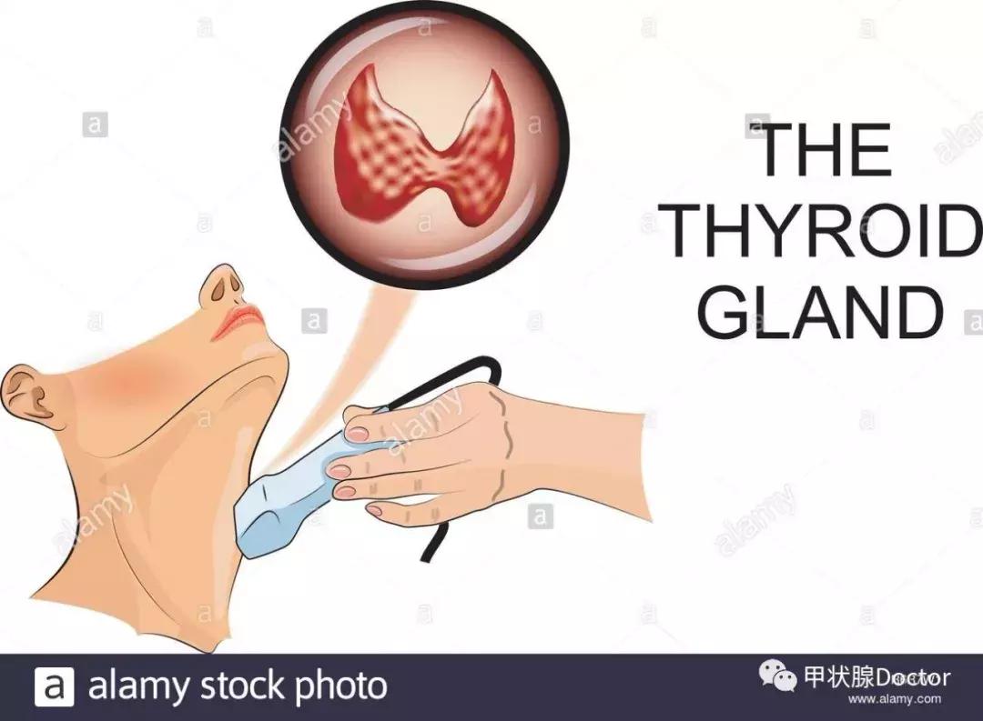 甲功tsh高对血压有影响吗,甲功tsh高有什么危害