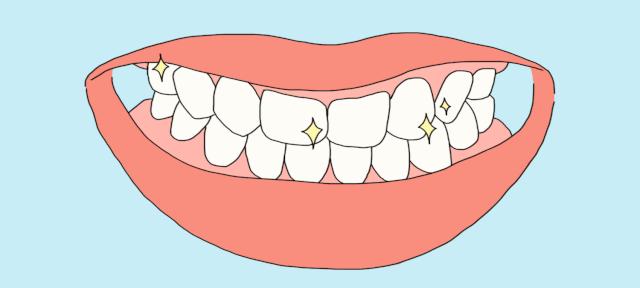 种植牙一万多的是什么牙齿,8000的种植牙和10000种植牙区别