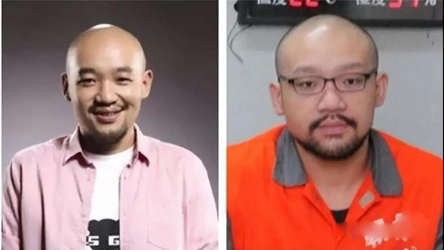 毛发检测毒主要是检测哪里的毛发,毛发检测毒可以查哪几种