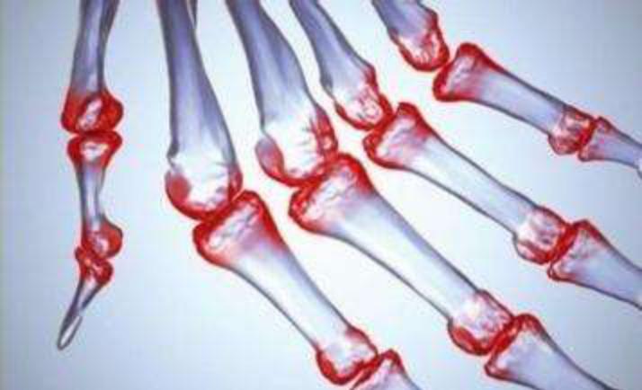 一变天就有反应，难道身体真有“预测天气”的功能