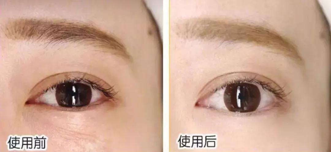 明星童颜秘诀，每1秒卖出10瓶的TA，素人高呼有效淡纹、去暗沉！