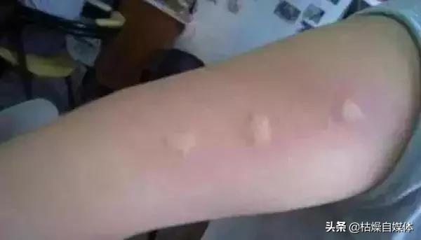 日本蚊子黑科技,灭蚊子神器日本