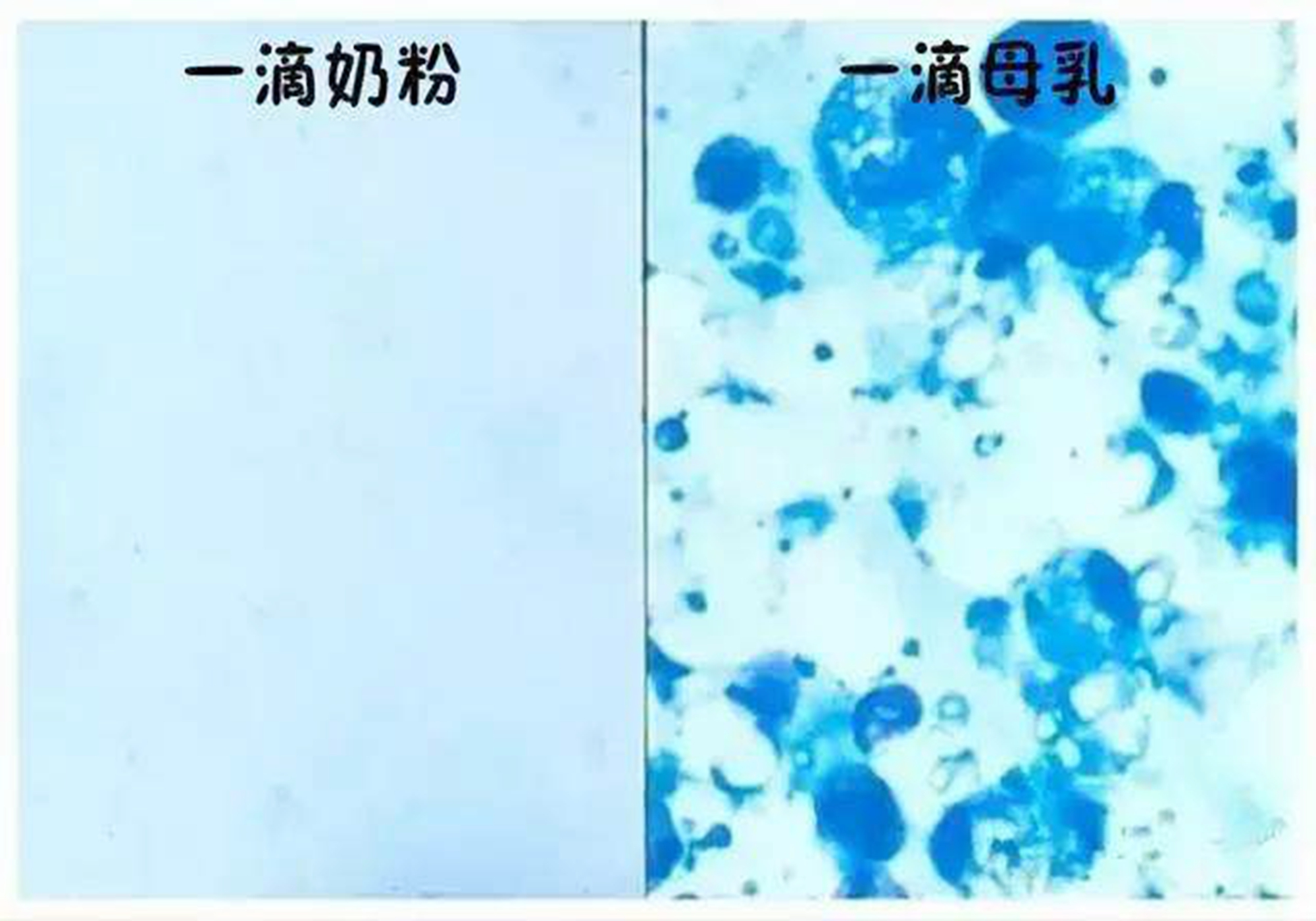 母乳放大100倍原来真的是血做的,母乳在显微镜下被放大1000倍