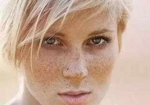 脸部四白穴有斑,按印堂穴可以祛斑吗