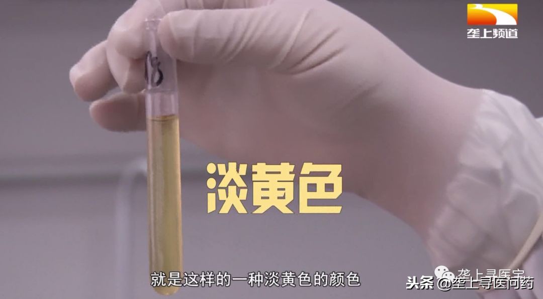 尿液可以保留多久才能做尿检,尿检前一天晚上需要注意什么