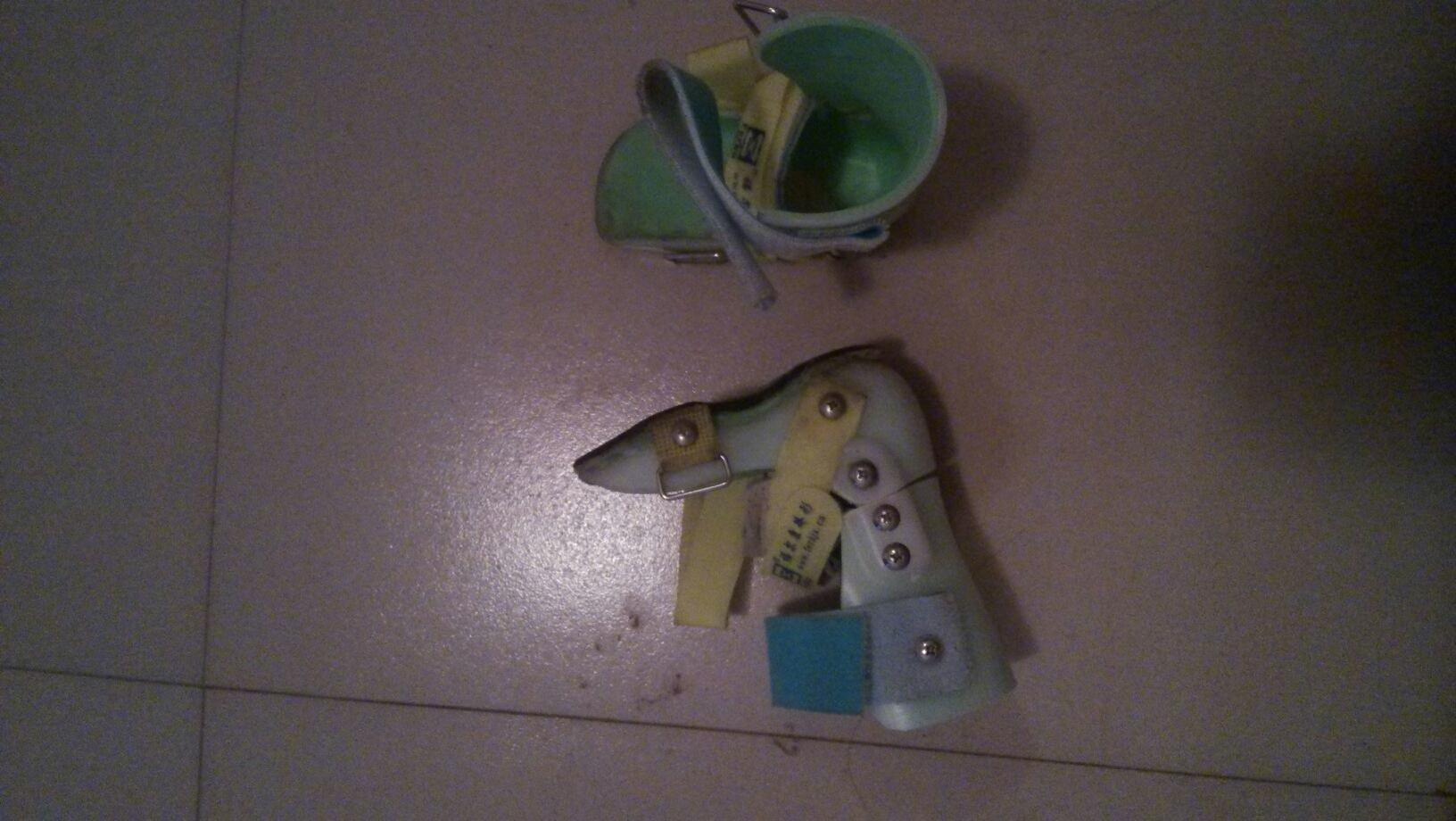 3岁足外翻到底要不要干预,儿童足外翻要早干预吗