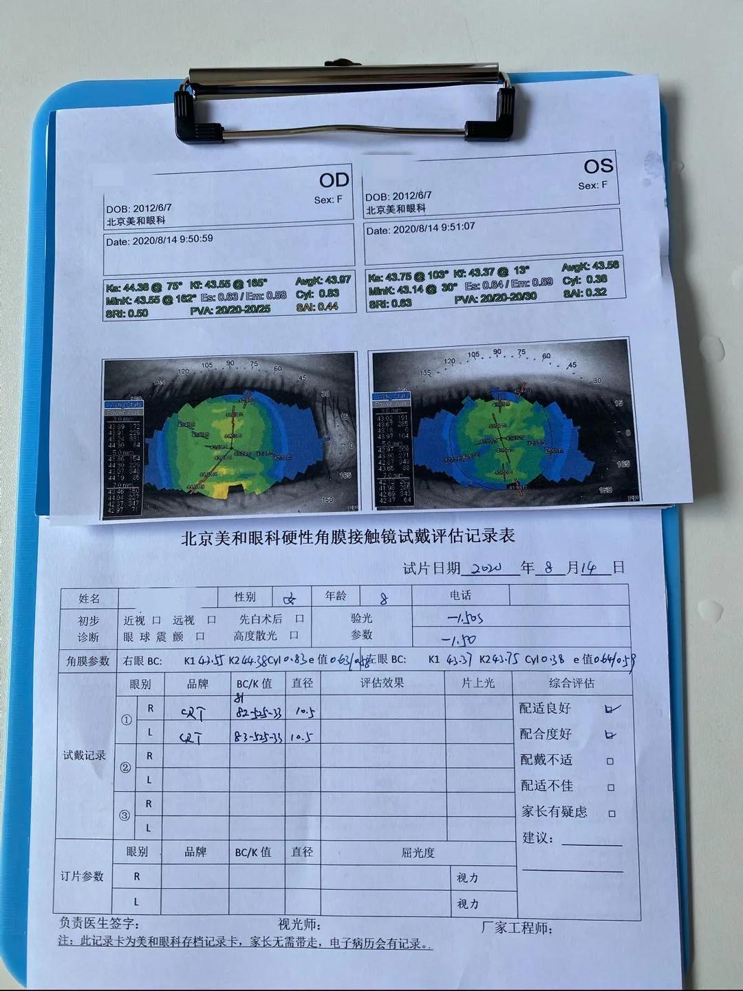 我的天！8岁暖暖竟然150度真性近视了