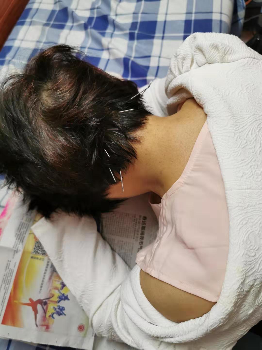 颈椎病56个经典例子,坚持这3个方法颈椎病居然痊愈了