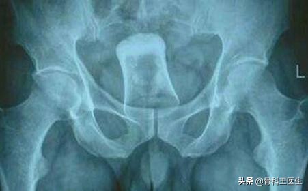 为什么会有人塞异物到直肠里,为什么会有人往尿道里塞异物