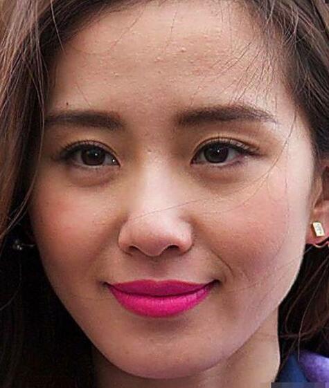 怎么收缩毛孔解决毛孔粗大小妙招,毛孔粗大怎么办教你几招收缩毛孔