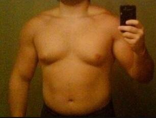 男性胸部脂肪可以锻炼消除吗,男性胸部脂肪俯卧撑可以减下去吗