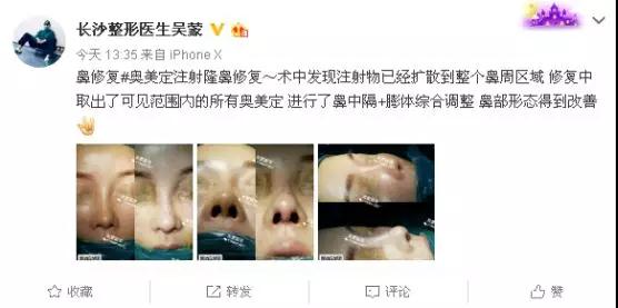 困扰十年鼻炎有多痛苦,困扰10年的鼻炎治好了