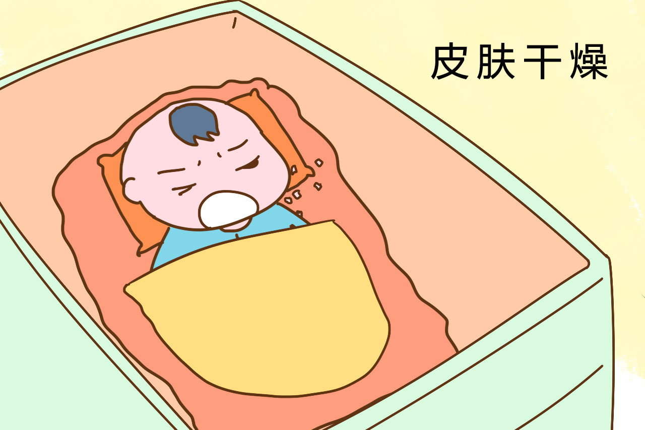 新生儿照蓝光后皮肤干燥怎么办,新生儿皮肤干燥裂口怎么回事呢