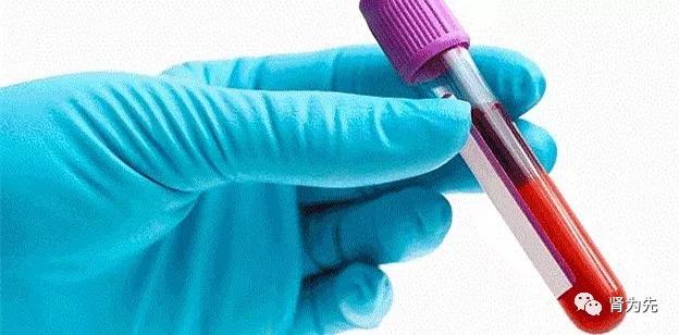 肾功能检查报告只有尿素氮升高,血尿素氮偏高会引起哪些症状