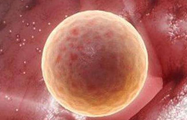 排卵期有拉丝分泌物是排卵吗,排卵期白带多是卵子质量好吗