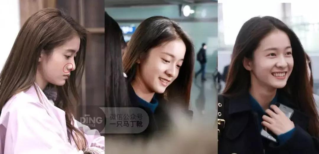 凹面型侧脸怎么改善,凹面型侧脸是怎么造成的