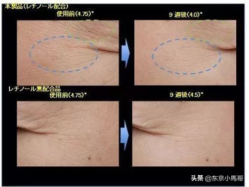 怡丽丝尔去皱效果好吗,世界干皮祛皱霜早晚十强