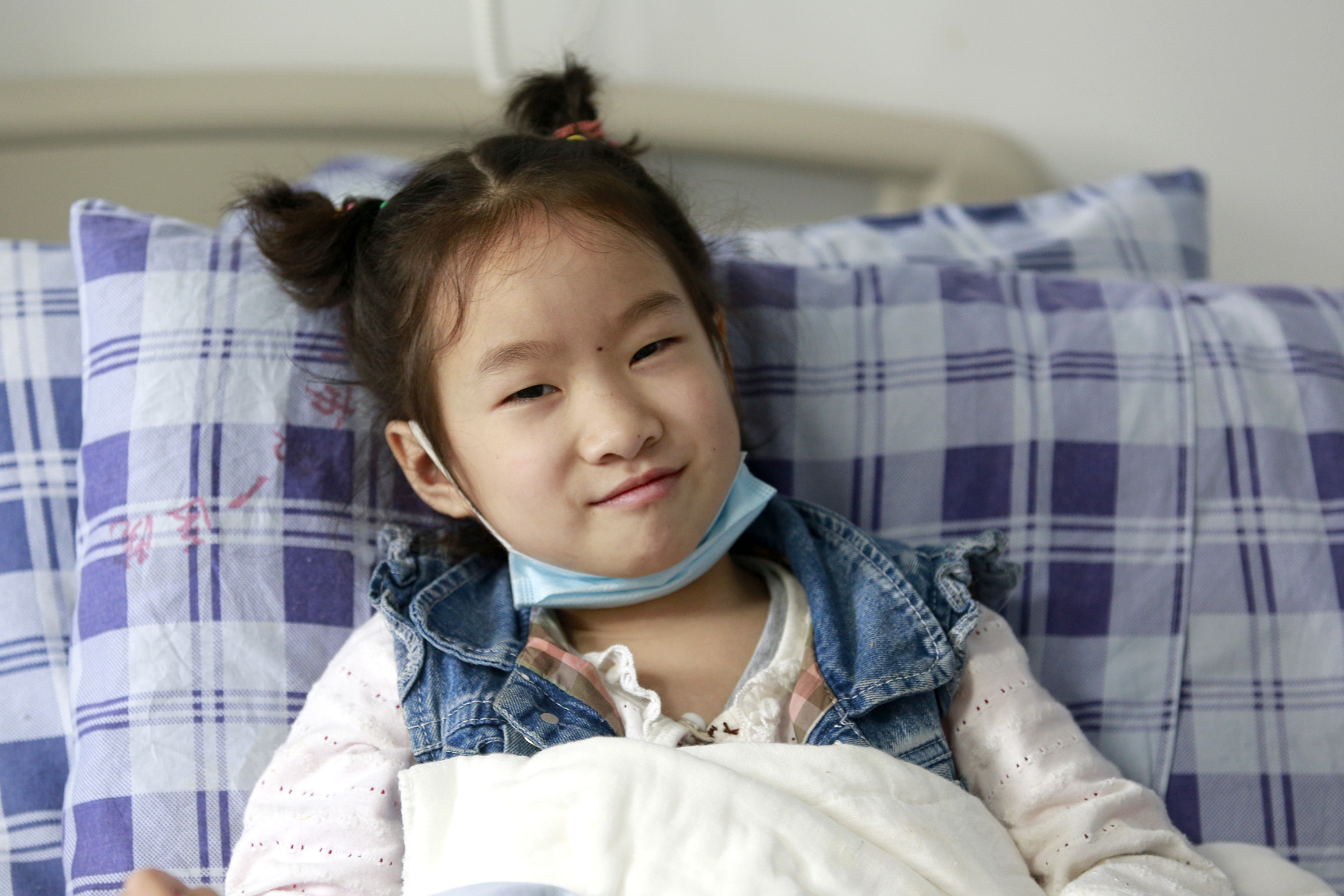 全身烫伤的那些人现在过得怎么样,烫伤女孩恢复过程