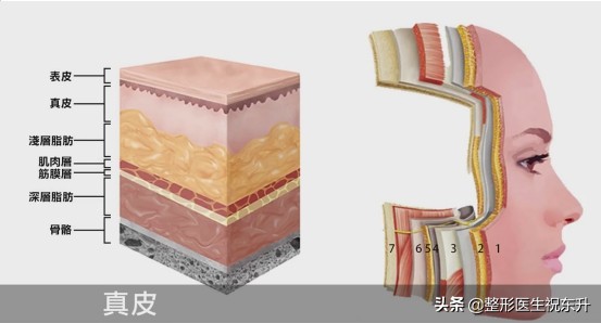 超声刀对皮肤有伤害吗,超声刀做的是哪一层的皮肤