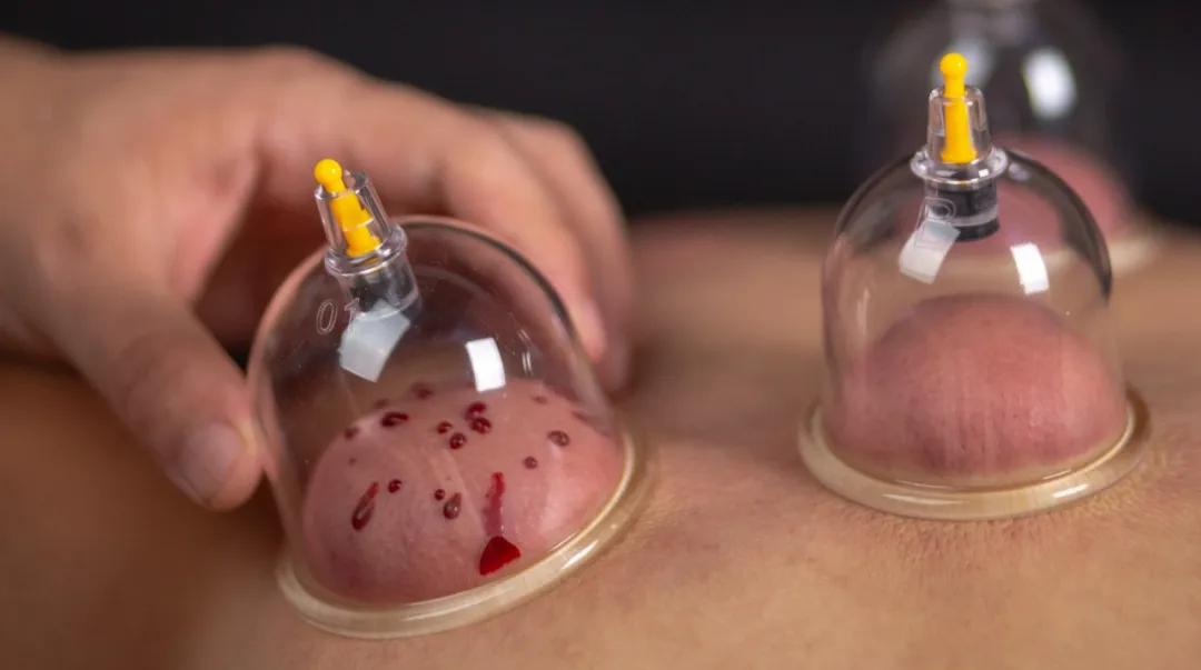 排毒的误区有哪些越排越伤身,有哪些真正有效的排毒方法