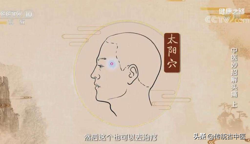 有治疗顽固性头痛的秘方吗,顽固性头痛有什么偏方