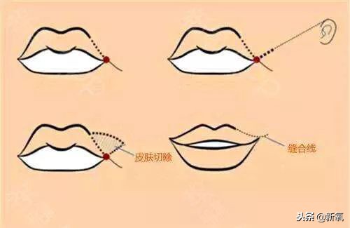 辛芷蕾是苦相女生吗,辛芷蕾气质怎么养成