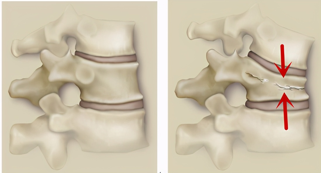 翻身痛坐起来也痛是怎么回事呀,呼吸翻身疼痛是什么原因