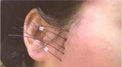 氧气女神的视频,氧气女神的照片