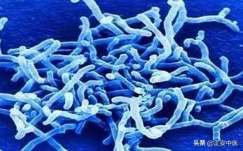 便秘引起的小肚腩怎么办,告别便秘最好的方法