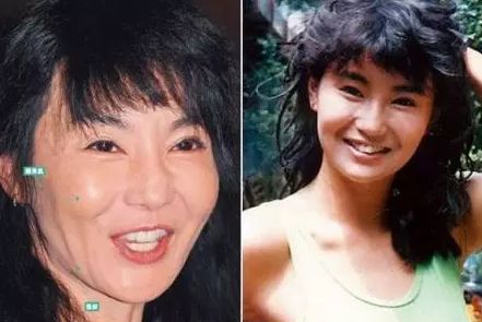 脸颊胶原蛋白补充,脸颊凹陷胶原蛋白流失如何补过来