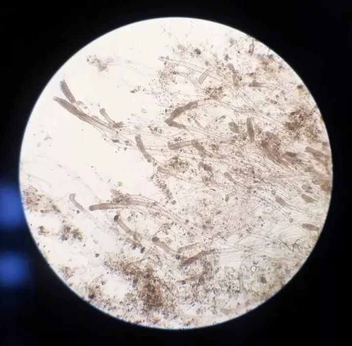 鱼类水霉病,春季鱼类水霉病症状