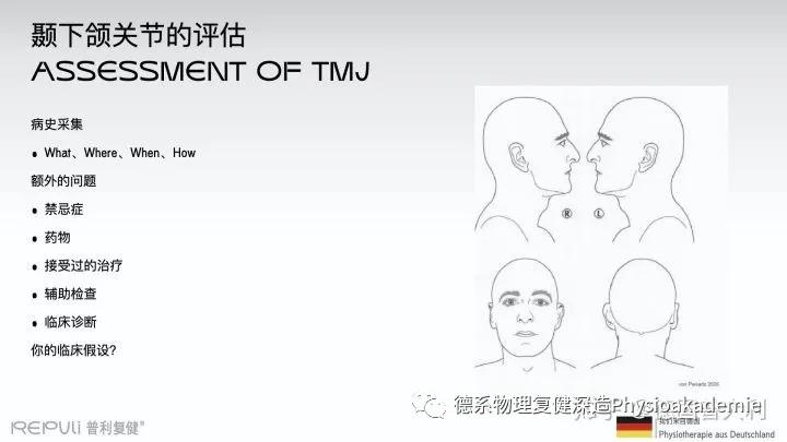 颞下颌关节紊乱综合征,颞下颌关节紊乱主要检查什么项目