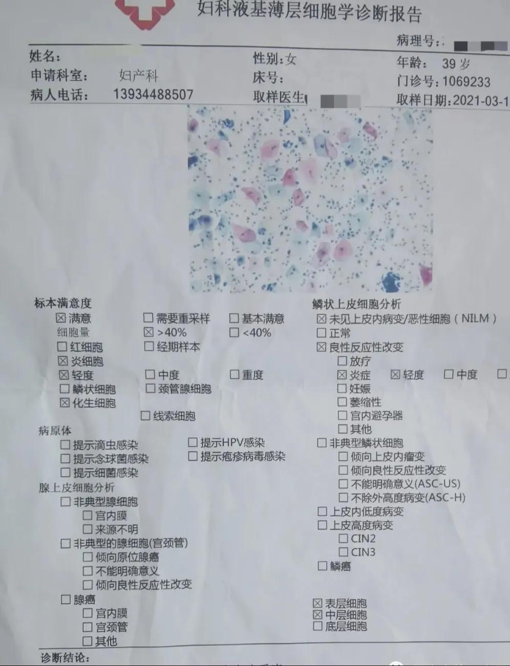 宫颈癌的介绍,有关宫颈癌的相关资料