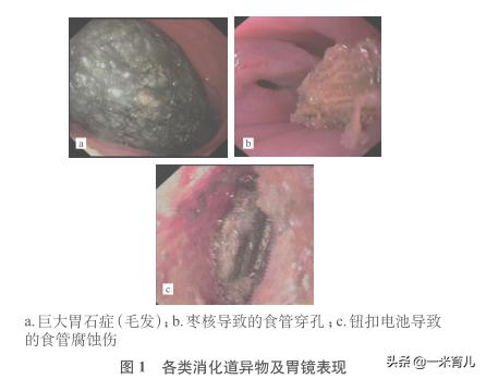 儿童消化道异物处理,小孩吃了耳环塞异物怎么办