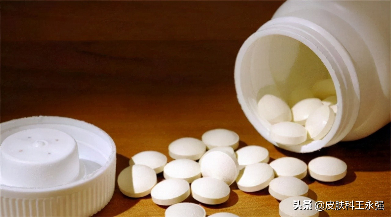 汗疱疹瘙痒严重怎么办,汗疱疹奇痒无比如何缓解