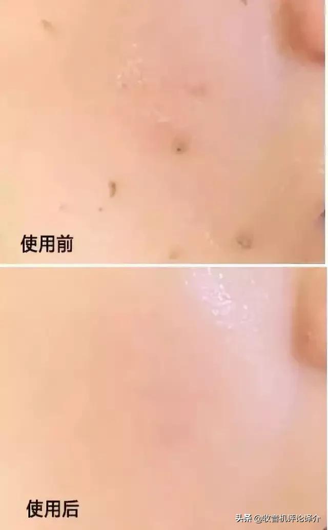 泰国发明的去角质慕斯火了!搓一搓脏东西就出来,脸上干净又白嫩