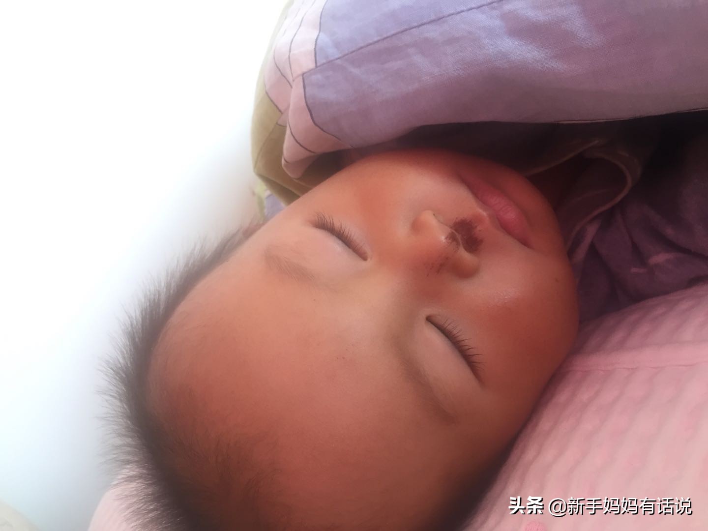 一岁半的宝宝鼻炎怎么办,一岁半的宝宝鼻炎怎么治疗